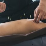 How can acupuncture help?