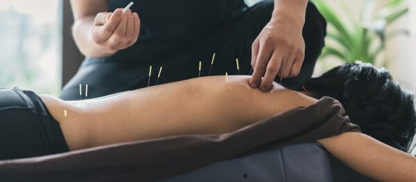 How can acupuncture help?